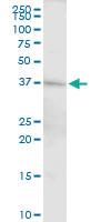 Anti-DFFA Rabbit Polyclonal Antibody