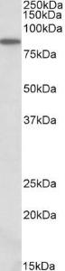 Anti-ALDH18A1 Antibody (A82892) (0.3 µg/ml) staining of NIH3T3 lysate (35 µg protein in RIPA buffer). Primary incubation was 1 hour. Detected by chemilu minescence