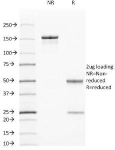 SDS-PAGE analysis of Anti-Cytokeratin 7 + 17 Antibody [C-46] under non-reduced and reduced conditions; showing intact IgG and intact heavy and light chains, respectively. SDS-PAGE analysis confirms the integrity and purity of the Antibody