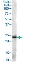 Anti-GSTP1 Goat Polyclonal Antibody