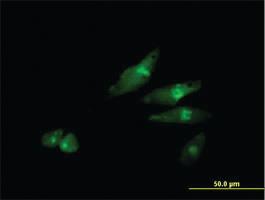 Anti-SCYL3 Mouse Polyclonal Antibody