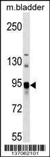 Anti-ASAH2 Rabbit Polyclonal Antibody (AP (Alkaline Phosphatase))