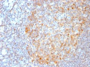 Anti-MALT1 antibody