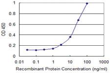 Anti-TKFC Mouse Monoclonal Antibody [clone: 1D9]