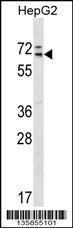 Anti-MED26 Rabbit Polyclonal Antibody (Biotin)