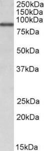 Anti-ALDH18A1 Antibody (A82892) (1 µg/ml) staining of MCF7 lysate (35 µg protein in RIPA buffer). Primary incubation was 1 hour. Detected by chemilu minescence