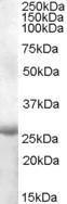 Anti-APOBEC2 Antibody (A84491) (1 µg/ml) staining of Human Muscle lysate (35 µg protein in RIPA buffer). Primary incubation was 1 hour. Detected by chemiluminescence