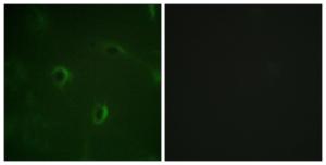 Immunofluorescence analysis of HUVEC cells using Anti-IR Antibody. The right hand panel represents a negative control, where the antibody was pre-incubated with the immunising peptide.