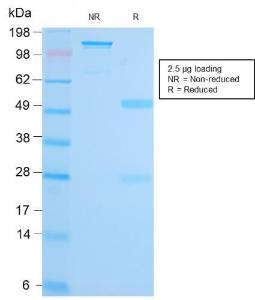 Anti-MALT1 antibody