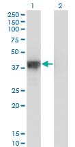 Anti-DFFA Mouse Monoclonal Antibody [clone: 3A11]