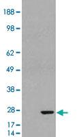 Anti-GSTP1 Goat Polyclonal Antibody