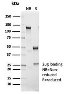 SDS-PAGE analysis of Anti-IL-1 beta Antibody [IL1B/7049R] under non-reduced and reduced conditions; showing intact IgG and intact heavy and light chains, respectively. SDS-PAGE analysis confirms the integrity and purity of the antibody