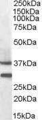 Anti-MC5R Antibody (A84492) (0.3µg/ml) staining of Mouse Muscle lysate (35µg protein in RIPA buffer). Detected by chemiluminescence.