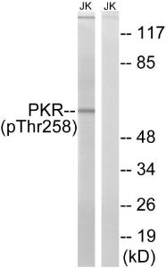 Western blot analysis of lysates from Jurkat cells treated with starved 24h using Anti-PKR (phospho Thr258) Antibody The right hand lane represents a negative control, where the antibody is blocked by the immunising peptide