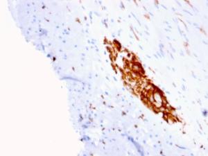 Immunohistochemical analysis of formalin-fixed, paraffin-embedded human colon using Anti-NCAM1 Antibody [ERIC-1]