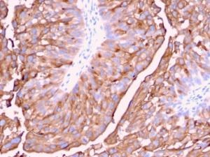 Immunohistochemical analysis of formalin-fixed, paraffin-embedded human urinary bladder using Anti-Uroplakin 1A Antibody [UPK1A/2921]