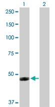 Anti-IFI44 Rabbit Polyclonal Antibody