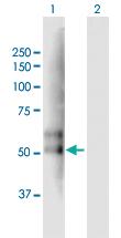 Anti-TMPRSS2 Mouse Polyclonal Antibody