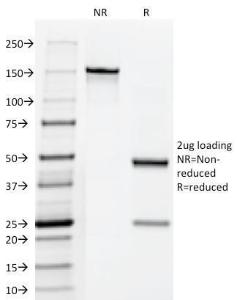 Anti-HCG Holo antibody