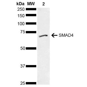 Western blot analysis of human Cervical cancer cell line (HeLa) lysate showing detection of ~604 kDa SMAD4 protein using Anti-Smad4 Antibody (A304891)