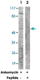 Anti-CK8 Rabbit Polyclonal Antibody