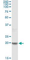 Anti-FTL Antibody Pair