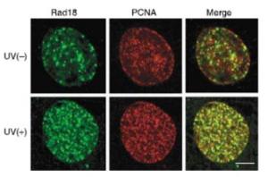 Anti-Rad18 Rabbit Polyclonal Antibody