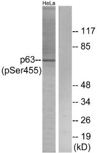 Western blot analysis of lysates from HeLa cells treated with TNF 2500U/ML 30' using Anti-p63 (phospho Ser455) Antibody The right hand lane represents a negative control, where the antibody is blocked by the immunising peptide