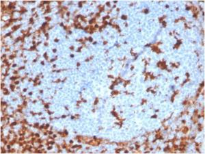 Immunohistochemical analysis of formalin-fixed, paraffin-embedded human tonsil using Anti-Annexin A1 Antibody [ANXA1/3869R]