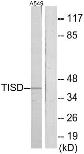 Western blot analysis of lysates from A549 cells using Anti-TISD Antibody. The right hand lane represents a negative control, where the antibody is blocked by the immunising peptide