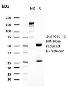 SDS-PAGE analysis of Anti-Uroplakin 1A Antibody [UPK1A/2921] under non-reduced and reduced conditions; showing intact IgG and intact heavy and light chains, respectively. SDS-PAGE analysis confirms the integrity and purity of the antibody.