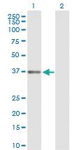 Anti-DFFB Rabbit Polyclonal Antibody