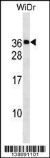 Anti-MED30 Rabbit Polyclonal Antibody (AP (Alkaline Phosphatase))