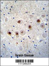 Anti-RBM14 Rabbit Polyclonal Antibody (PE (Phycoerythrin))