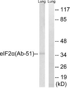 Western blot analysis of lysates from rat lung using Anti-eIF2 alpha Antibody. The right hand lane represents a negative control, where the antibody is blocked by the immunising peptide