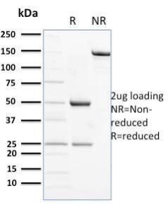 SDS-PAGE analysis of Anti-NCAM1 Antibody [ERIC-1] under non-reduced and reduced conditions; showing intact IgG and intact heavy and light chains, respectively. SDS-PAGE analysis confirms the integrity and purity of the antibody.