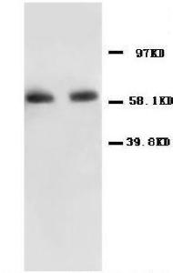 Anti-NF-kB p65 Rabbit Polyclonal Antibody