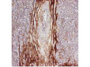 RB Anti-osteopoietin (Human)