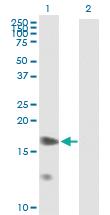 Anti-PTGES Mouse Polyclonal Antibody