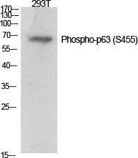 Western blot analysis of various cells using Anti-p63 (phospho Ser455) Antibody