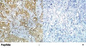 Anti-ABL1 Rabbit Polyclonal Antibody