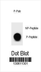 Anti-BCL2 Rabbit Polyclonal Antibody (FITC (Fluorescein Isothiocyanate))