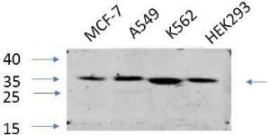 Western blot analysis of various cells using Anti-eIF2 alpha Antibody at 1:1,000 (4°C overnight). Goat Anti-Rabbit IgG (IRDye 800) was used as a secondary at 1:5,000 (25°C, 1 hour)