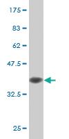 Anti-MAPK8 Mouse Monoclonal Antibody [clone: 1E1]