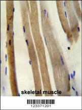 Anti-CS Rabbit Polyclonal Antibody