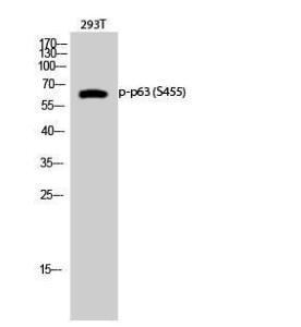 Western blot analysis of 293T cells using Anti-p63 (phospho Ser455) Antibody