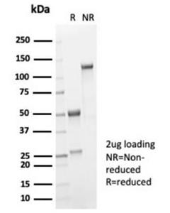 SDS-PAGE analysis of Anti-IL-2 Antibody [IL2/7051R] under non-reduced and reduced conditions; showing intact IgG and intact heavy and light chains, respectively. SDS-PAGE analysis confirms the integrity and purity of the antibody.