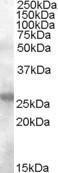 Anti-AICDA Antibody (A84494) (0.1µg/ml) staining of Human Tonsil lysate (35µg protein in RIPA buffer). Primary incubation was 1 hour. Detected by chemiluminescence.