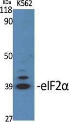 Western blot analysis of various cells using Anti-eIF2 alpha Antibody