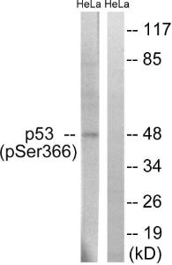 Anti-p53 Rabbit Polyclonal Antibody